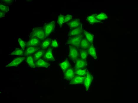 Polyclonal Rabbit anti-Human FACT / SSRP1 Antibody (IHC, IF, WB)