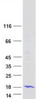 Human MED31 Protein (Recombinant Myc-DDK (Flag))