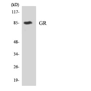 IHC-plus™ NR3C1/Glucocorticoid Receptor Antibody (aa147-196)