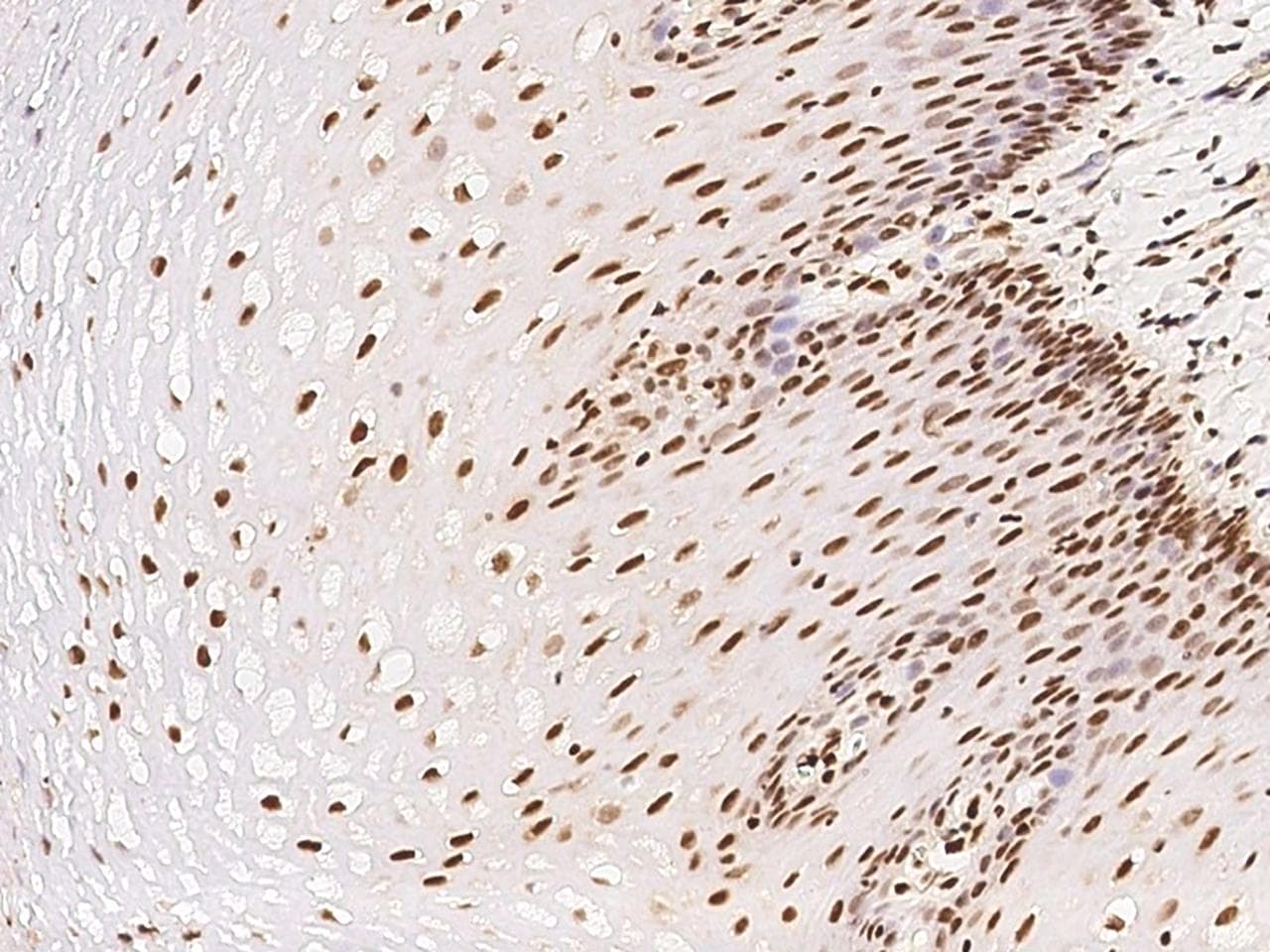 ETV3 Antibody