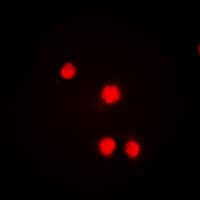 RORA / ROR Alpha Antibody (N-Terminus)