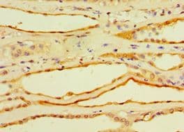 Polyclonal Rabbit anti-Human CFD / Factor D / Adipsin Antibody (aa26-253, IHC)
