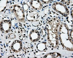 LOX / Lysyl Oxidase Antibody (clone OTI9G6)