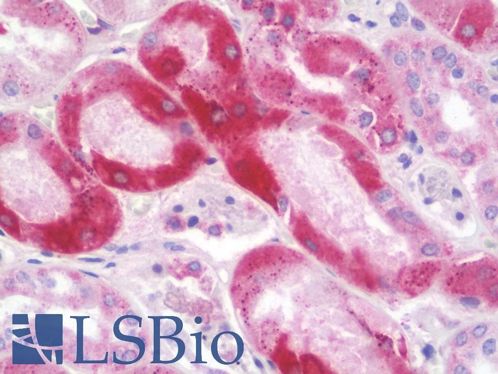 IHC-plus™ ERAP2 / Aminopeptidase Antibody
