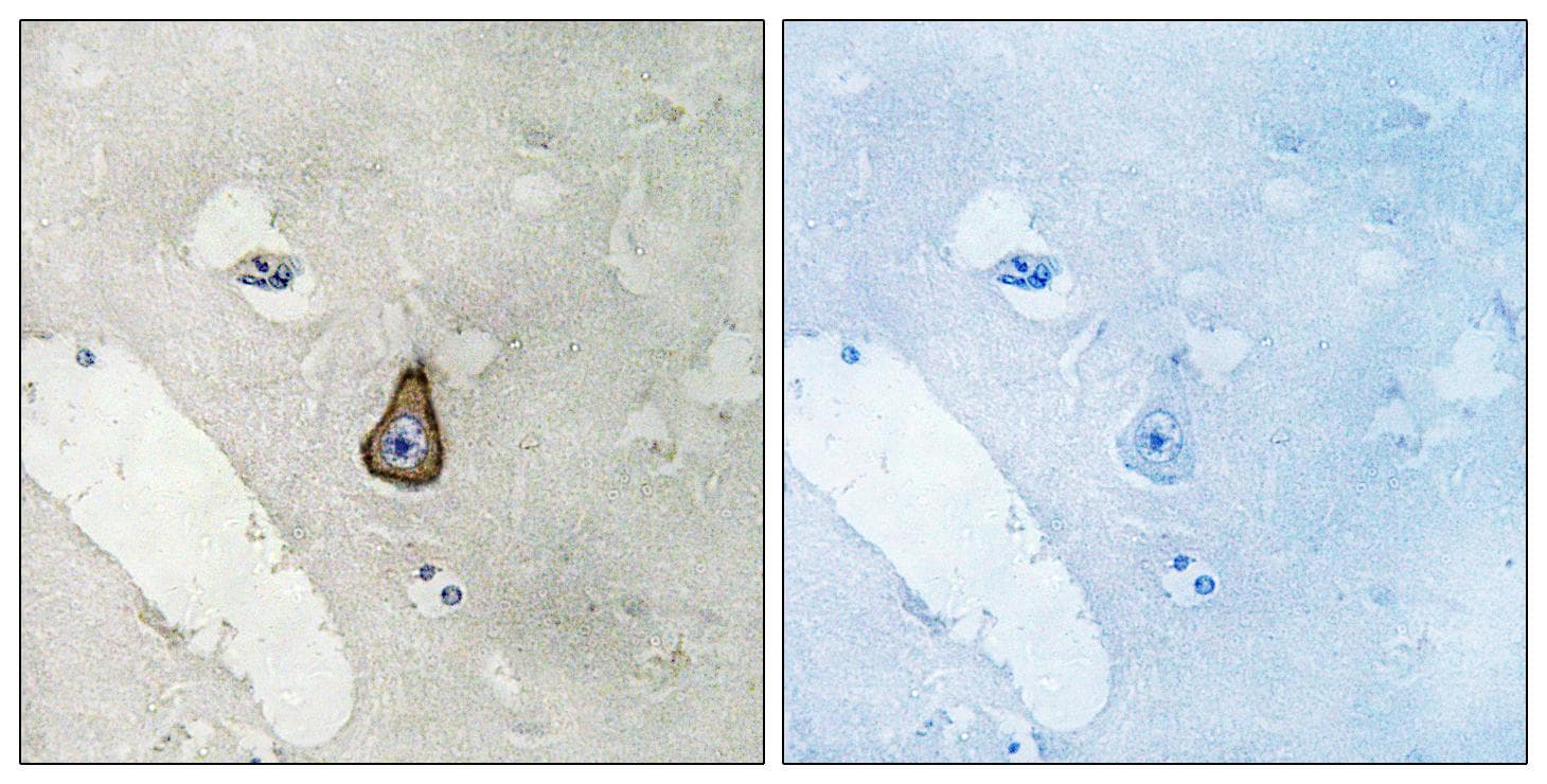 DLG2 / PSD93 Antibody