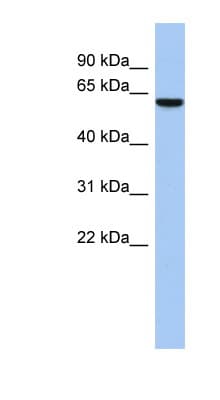 Polyclonal Rabbit anti-Human LEMD2 Antibody (C-Terminus, WB)