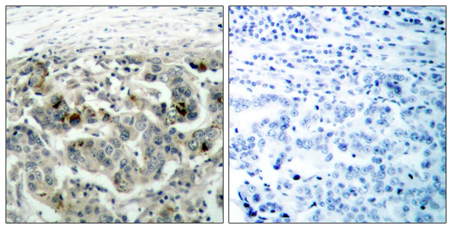 Polyclonal Rabbit anti-Human NFKB1 / NF-Kappa-B Antibody (aa874-923, IHC, WB)