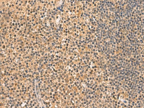 UCHL1 / PGP9.5 Antibody