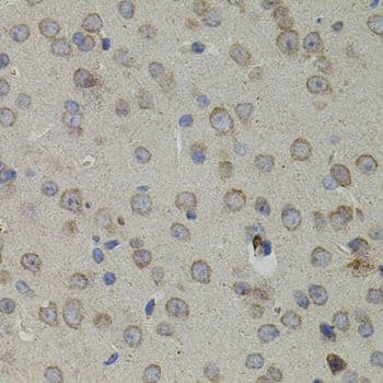 Vimentin Antibody