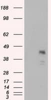 IHC-plus™ Monoclonal Mouse anti-Human MCL1 / MCL 1 Antibody (clone 2E11, IHC, IF, WB)