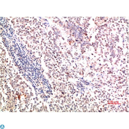 Collagen II Antibody