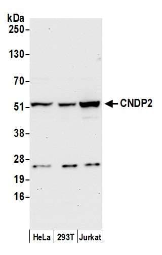 CNDP2 Antibody (aa425-475)