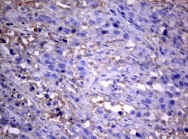 PIK3C2A Antibody (aa230-560, clone OTI3H2)