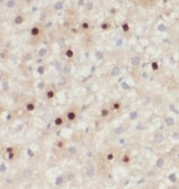 Polyclonal Rabbit anti-Human GSTP1 / GST Pi Antibody (IHC, IF, WB)