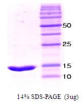 Human LAIR1 / CD305 Protein (Recombinant)