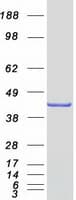 Human ECI2 / PECI Protein (Recombinant Myc-DDK (Flag))