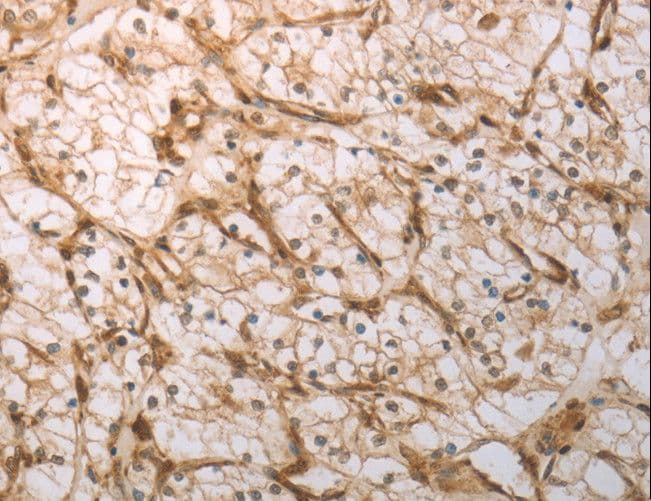 Polyclonal Rabbit anti-Human INHA / Inhibin Alpha Antibody (IHC)