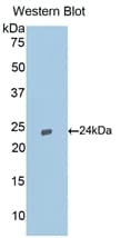 CASP9 / Caspase 9 Antibody (aa1-200)