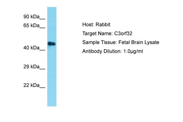 Polyclonal Rabbit anti-Human SSUH2 / C3orf32 Antibody (N-Terminus, WB)