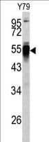 PDIA6 / ERP5 Antibody (aa144-172)