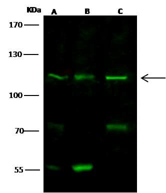 DSG1 / Desmoglein 1 Antibody (Preservative Free)