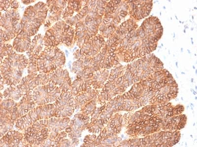 EPCAM Antibody (aa100-224, clone EGP40/2041R, Azide-free, Carrier-free)