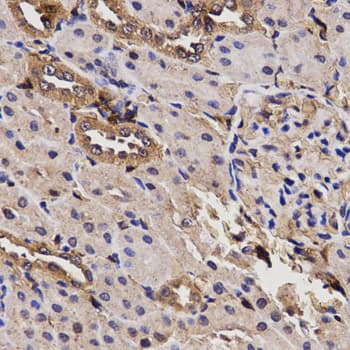 BCHE / Cholinesterase Antibody