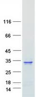 Human RAB26 Protein (Recombinant Myc-DDK (Flag))