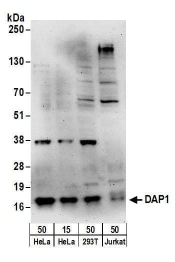 IHC-plus™ Polyclonal Goat anti-Human GAPDH Antibody (aa175-225, IHC, WB)