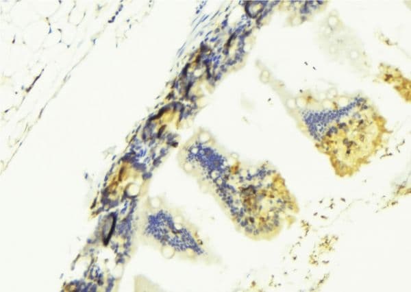Polyclonal Rabbit anti-Human TNFSF13 / APRIL Antibody (IHC, IF, WB)