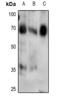 Polyclonal Rabbit anti-Human SMAD4 Antibody (WB)