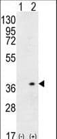 Polyclonal Rabbit anti-Human HLA-DQA1 Antibody (aa39-66, WB)