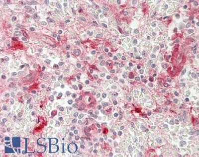 IHC-plus™ TROP2 / TACSTD2 Antibody (Internal)