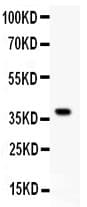 GCLC Antibody (aa437-637)