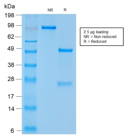 NCAM / CD56 Antibody (clone NCAM1/2217R, Azide-free, Carrier-free)