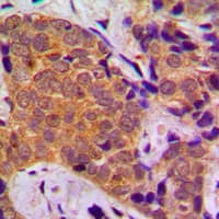 FOXO1 / FKHR Antibody (Internal)
