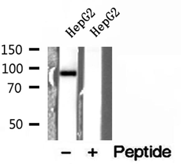 Polyclonal Rabbit anti-Human ELAC2 Antibody (IHC, WB)