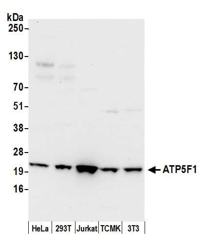 Polyclonal Rabbit anti-Human ATP5F1 Antibody (aa25-75, WB)
