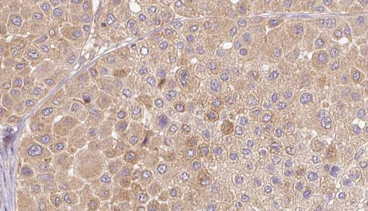 Polyclonal Rabbit anti-Human PSG3 Antibody (IHC, IF, WB)