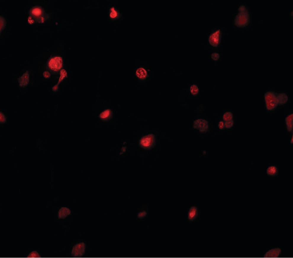 IHC-plus™ KIAA0141 Antibody