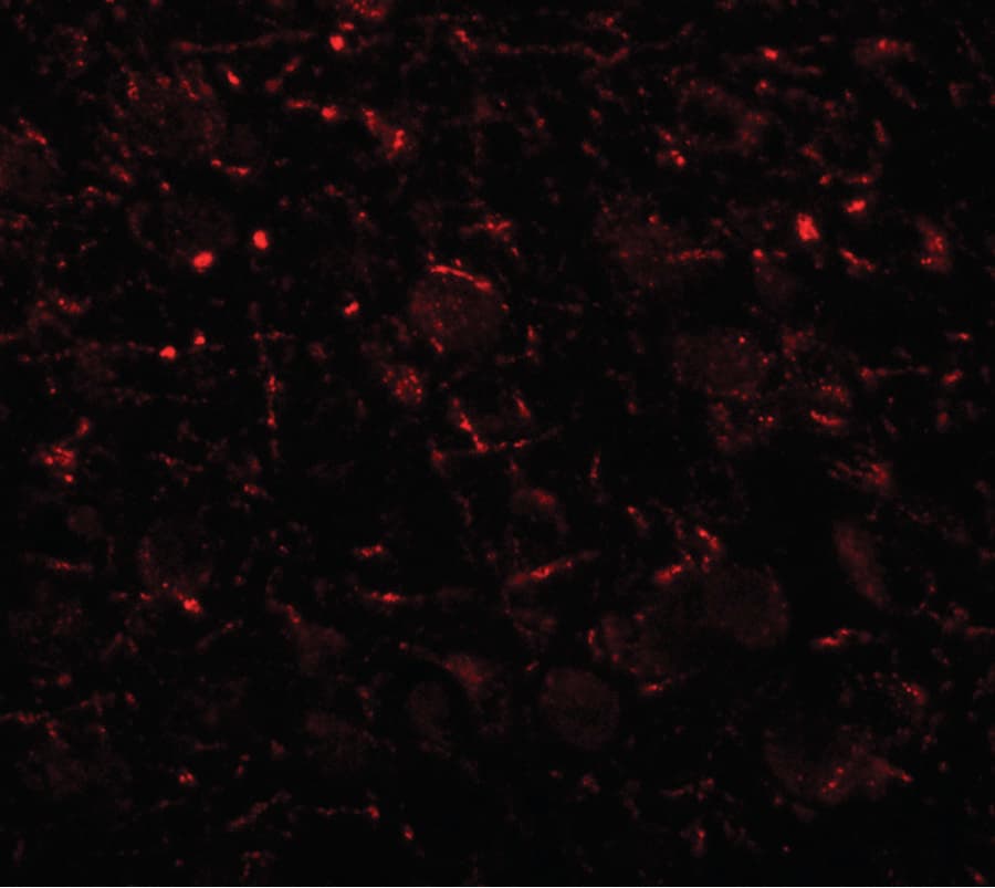 IHC-plus™ AP3B2 Antibody