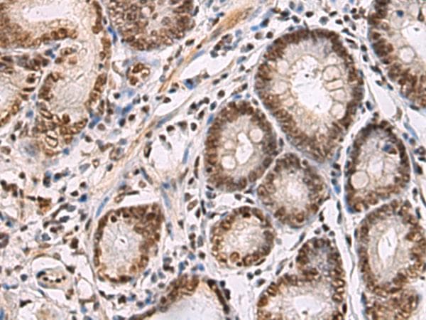 Polyclonal Rabbit anti-Human CREBBP / CREB Binding Protein Antibody (IHC)