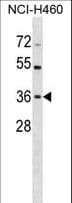 Polyclonal Rabbit anti-Human HUS1 Antibody (aa199-226, WB)