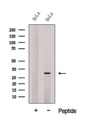 Polyclonal Rabbit anti-Human DCUN1D5 Antibody (WB)