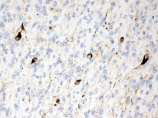 INA / Alpha Internexin Antibody