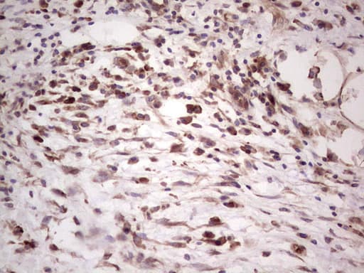 Monoclonal Mouse anti-Human DMN / Desmuslin / Synemin Antibody (clone OTI7H6, aa329-580, IHC, WB)