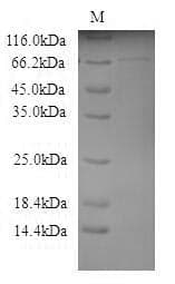 Mouse GALC / Galactocerebrosidase Protein (Recombinant)