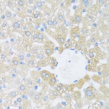 Polyclonal Rabbit anti-Human KIAA1811 / BRSK1 Antibody (IHC)