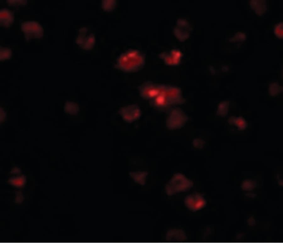 IHC-plus™ TSHZ2 Antibody