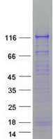 Human LLGL2 Protein (Recombinant Myc-DDK (Flag))